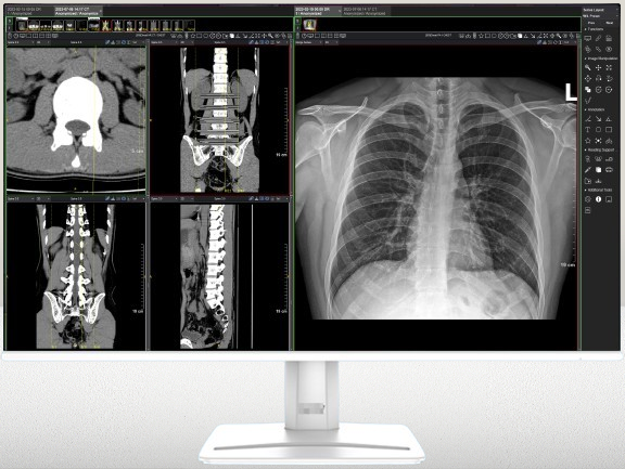 iRadView Viewer