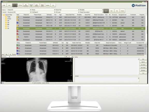 iRadView Worklist